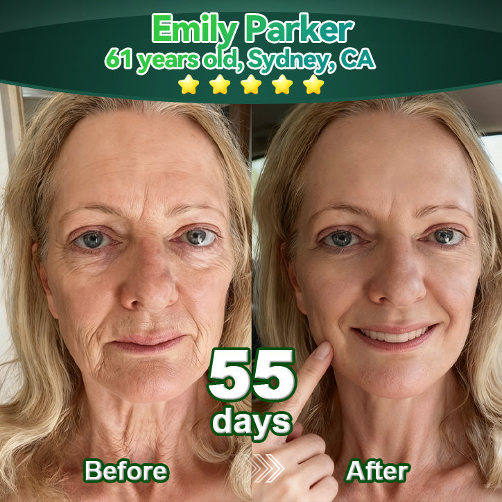 𝑳𝒐𝒕𝑚𝑎𝑦® 𝑆𝑡𝑒𝑚 𝐶𝑒𝑙𝑙 & 𝐶𝑜𝑙𝑙𝑎𝑔𝑒𝑛 𝑃𝑒𝑝𝑡𝑖𝑑𝑒 𝑂𝑟𝑎𝑙 𝐷𝑟𝑜𝑝𝑠 🌱(Lift & Firm Sagging Skin & Reduce Wrinkle Formation)💧