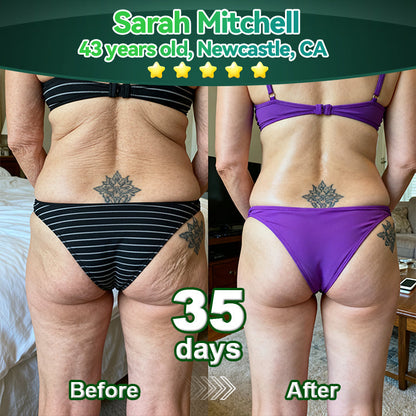 𝑳𝒐𝒕𝑚𝑎𝑦® 𝑆𝑡𝑒𝑚 𝐶𝑒𝑙𝑙 & 𝐶𝑜𝑙𝑙𝑎𝑔𝑒𝑛 𝑃𝑒𝑝𝑡𝑖𝑑𝑒 𝑂𝑟𝑎𝑙 𝐷𝑟𝑜𝑝𝑠 🌱(Lift & Firm Sagging Skin & Reduce Wrinkle Formation)💧