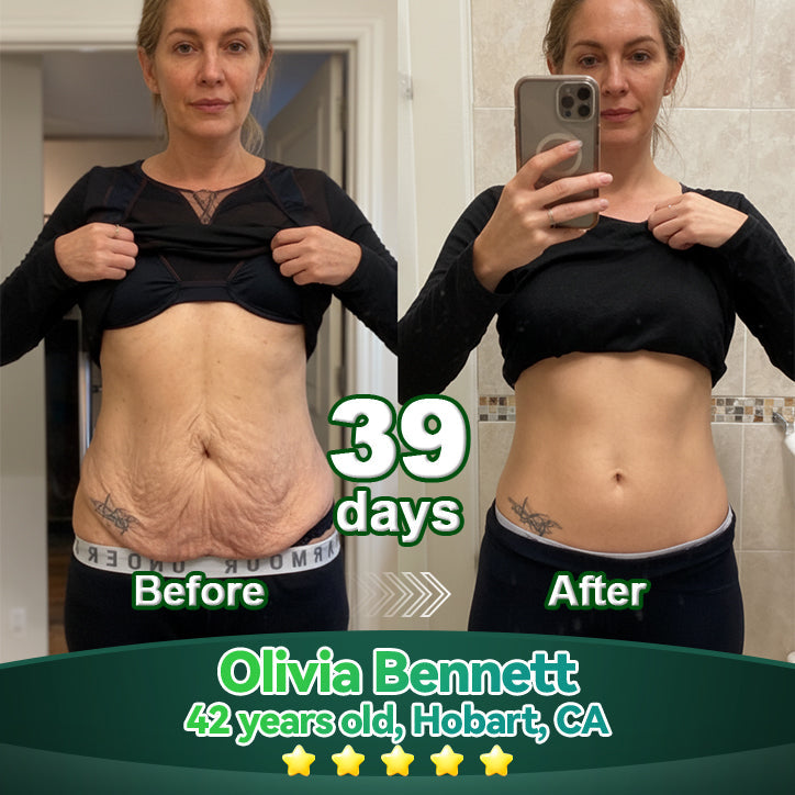 𝑳𝒐𝒕𝑚𝑎𝑦® 𝑆𝑡𝑒𝑚 𝐶𝑒𝑙𝑙 & 𝐶𝑜𝑙𝑙𝑎𝑔𝑒𝑛 𝑃𝑒𝑝𝑡𝑖𝑑𝑒 𝑂𝑟𝑎𝑙 𝐷𝑟𝑜𝑝𝑠 🌱(Lift & Firm Sagging Skin & Reduce Wrinkle Formation)💧