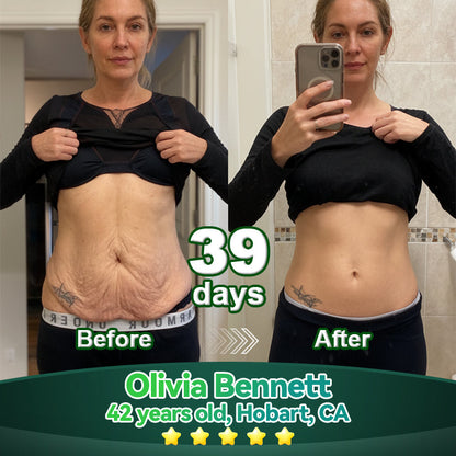 𝑳𝒐𝒕𝑚𝑎𝑦® 𝑆𝑡𝑒𝑚 𝐶𝑒𝑙𝑙 & 𝐶𝑜𝑙𝑙𝑎𝑔𝑒𝑛 𝑃𝑒𝑝𝑡𝑖𝑑𝑒 𝑂𝑟𝑎𝑙 𝐷𝑟𝑜𝑝𝑠 🌱(Lift & Firm Sagging Skin & Reduce Wrinkle Formation)💧