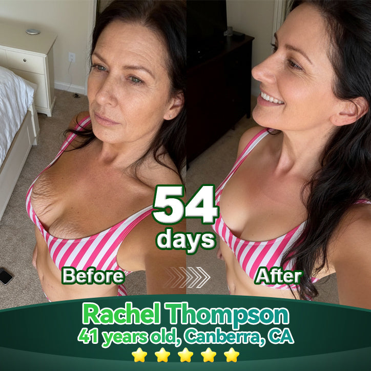 𝑳𝒐𝒕𝑚𝑎𝑦® 𝑆𝑡𝑒𝑚 𝐶𝑒𝑙𝑙 & 𝐶𝑜𝑙𝑙𝑎𝑔𝑒𝑛 𝑃𝑒𝑝𝑡𝑖𝑑𝑒 𝑂𝑟𝑎𝑙 𝐷𝑟𝑜𝑝𝑠 🌱(Lift & Firm Sagging Skin & Reduce Wrinkle Formation)💧