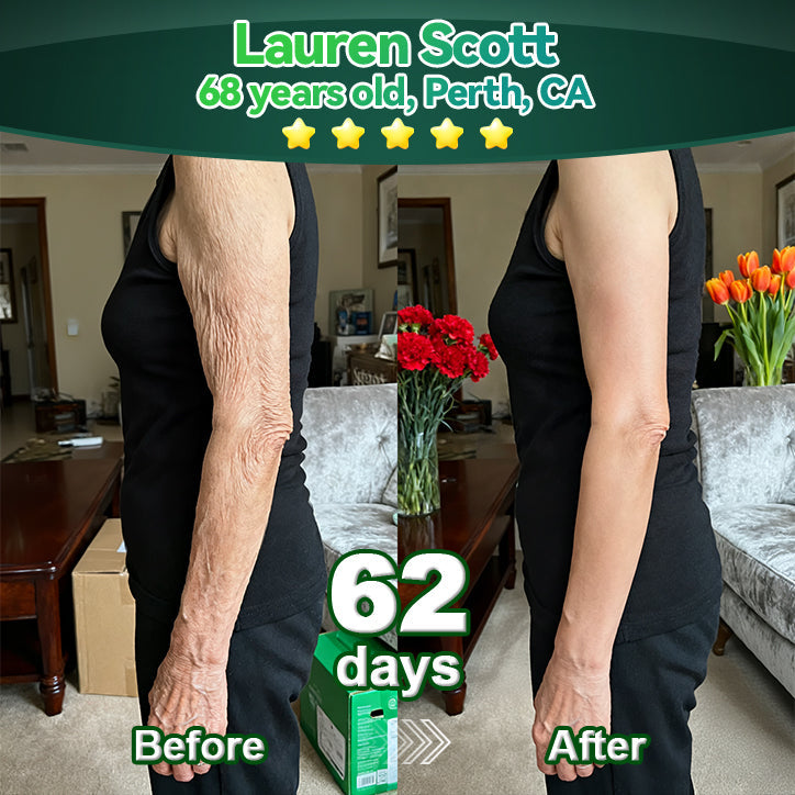 𝑳𝒐𝒕𝑚𝑎𝑦® 𝑆𝑡𝑒𝑚 𝐶𝑒𝑙𝑙 & 𝐶𝑜𝑙𝑙𝑎𝑔𝑒𝑛 𝑃𝑒𝑝𝑡𝑖𝑑𝑒 𝑂𝑟𝑎𝑙 𝐷𝑟𝑜𝑝𝑠 🌱(Lift & Firm Sagging Skin & Reduce Wrinkle Formation)💧